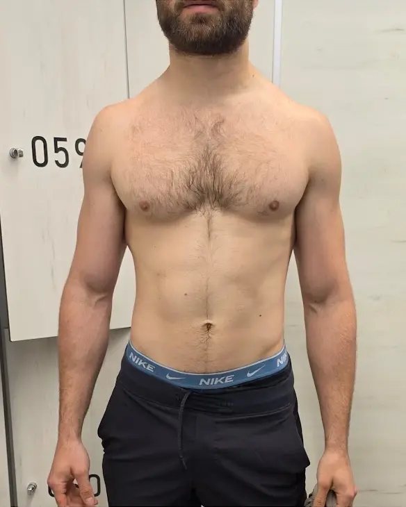 Cliente de LuxFigure, vista frontal: antes y después del plan de entrenamiento y nutrición (antes)