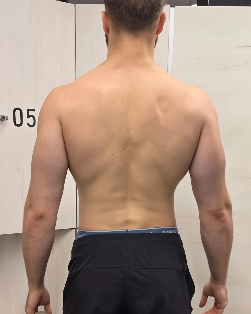 Cliente de LuxFigure, vista de espalda: antes y después del plan de entrenamiento y nutrición (antes)