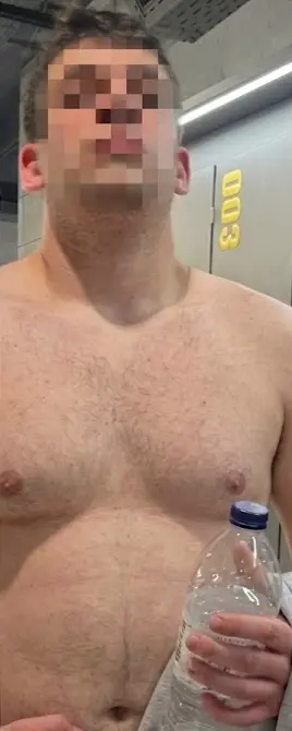 Cliente de LuxFigure, torso: antes y después de la pérdida de grasa abdominal (antes)