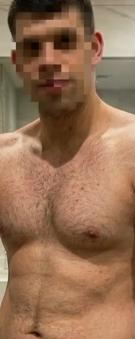 Cliente de LuxFigure, torso: antes y después de la pérdida de grasa abdominal (después)